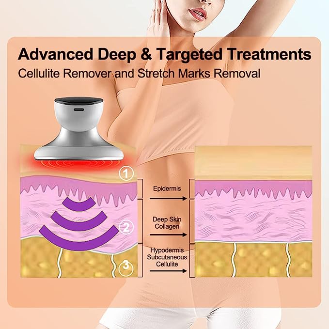 CENXIGO Cellulite Remover Body Massager for Women Belly Arms Thigh Hip Leg