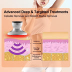 CENXIGO Cellulite Remover Body Massager for Women Belly Arms Thigh Hip Leg